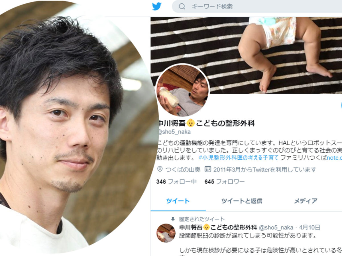 赤ちゃんの股関節脱臼心配 ツイッターで無料相談 つくば市の医師